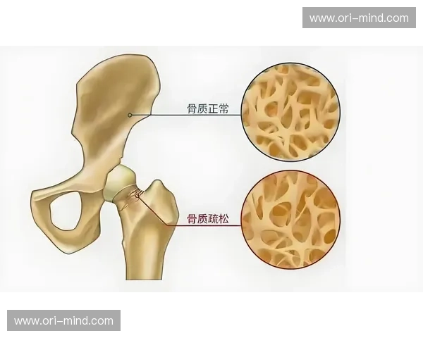骨骼强度与健康关系探讨:影响因素、评估方法及提升策略分析